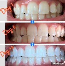 Whitening Toothpaste
